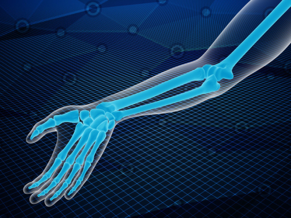 A 3-D medical scan graphic of an arm with 3 long bones coming together to form the elbow joint